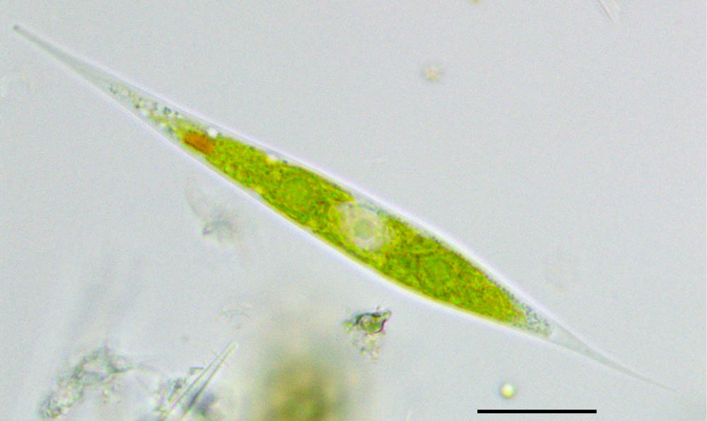クロロゴニウム （Chlorogonium sp.） の画像