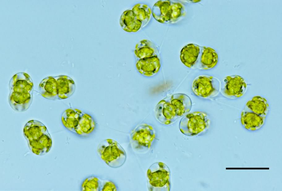 コスモクラディウム（Cosmocladium sp.）の画像