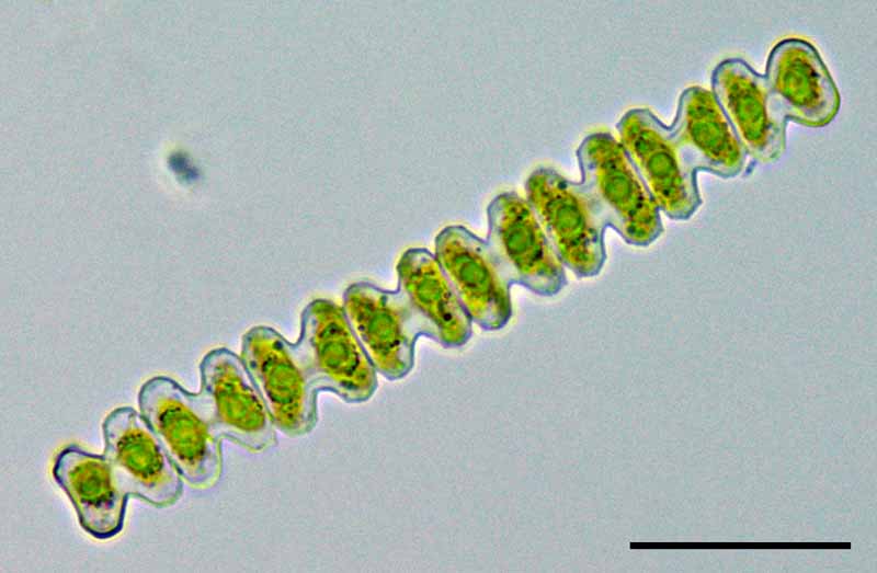 スファエロゾスマ　（Sphaerozosma granulata）の画像