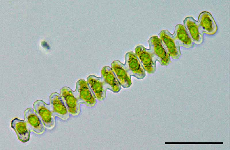 スファエロゾスマ　（Sphaerozosma granulata）の画像
