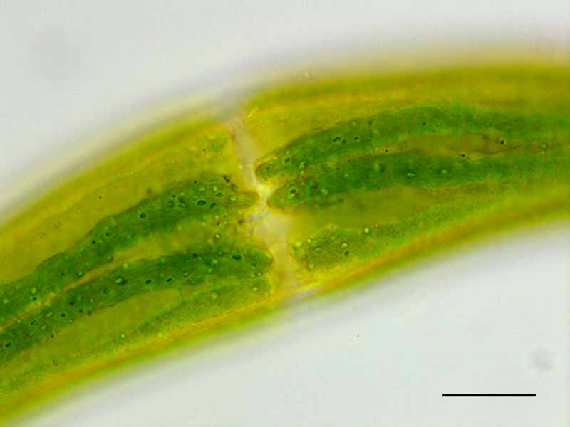 ミカヅキモ （Closterium moniliferum）の画像