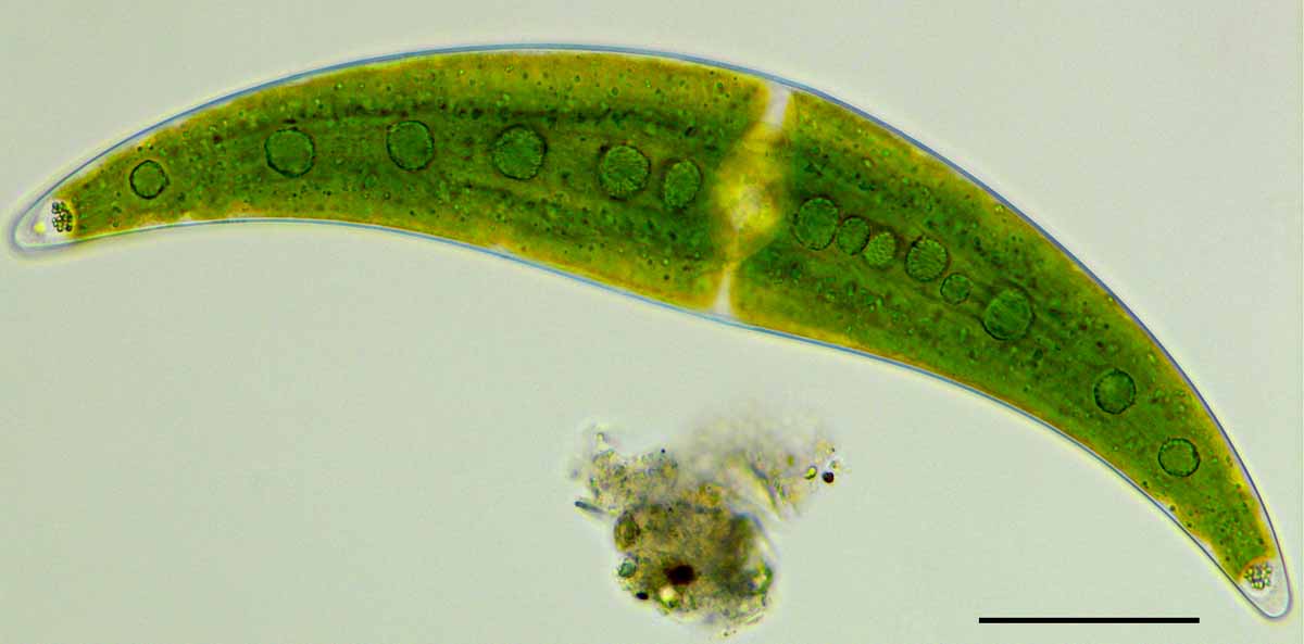 ミカヅキモ （Closterium moniliferum）の画像
