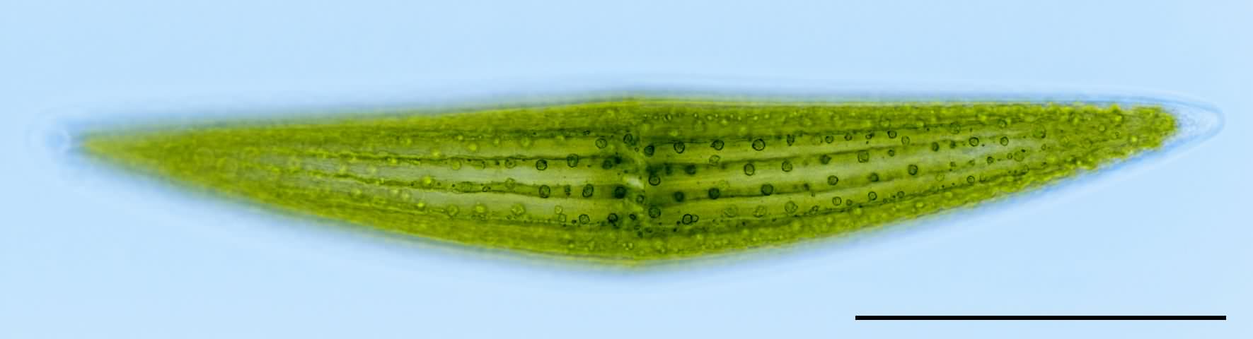 ミカヅキモ（Closterium sp.）の画像