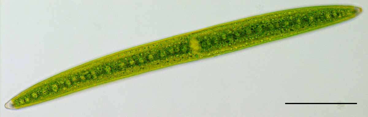 ミカヅキモ （Closterium sp.）の画像