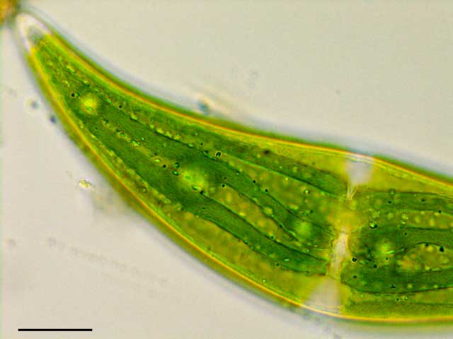 ミカヅキモ （Closterium sp.）の画像
