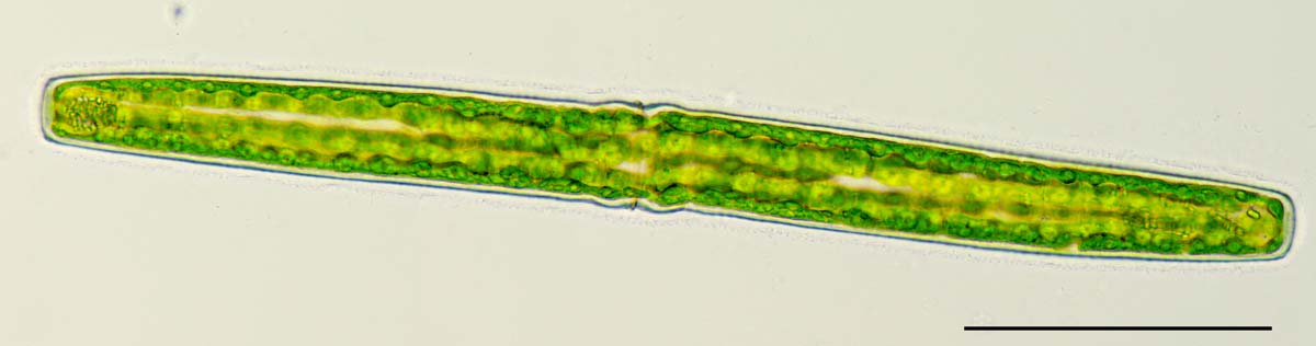 コウガイチリモ（Pleurotaenium sp.）の画像