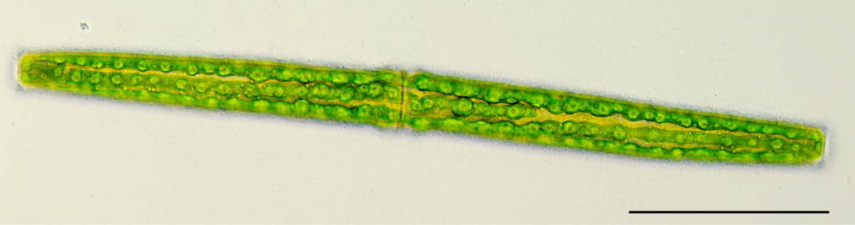 コウガイチリモ（Pleurotaenium sp.）の画像