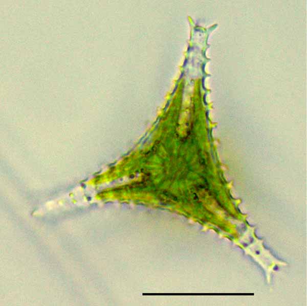 スタウラスツルム（Staurastrum sp.）の画像