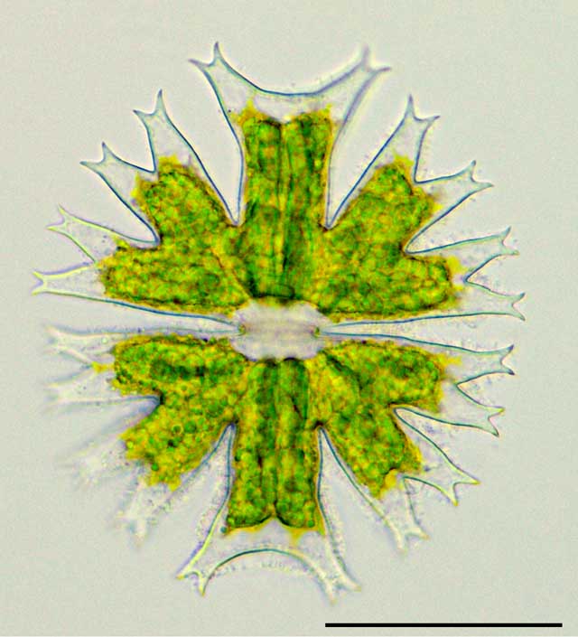 ミクラステリアス（Micrasterias crux-melitensis）の画像
