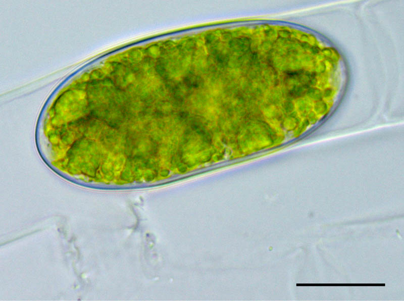 アオミドロ （Spirogyra sp.）接合子の画像