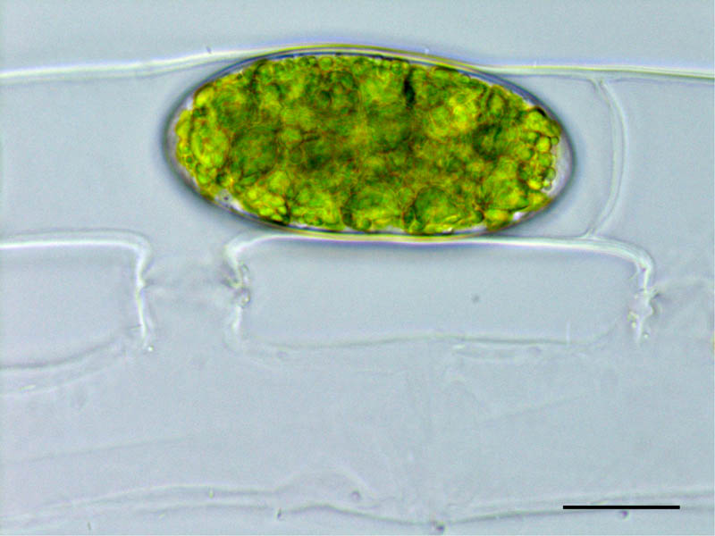 アオミドロ （Spirogyra sp.）接合子の画像