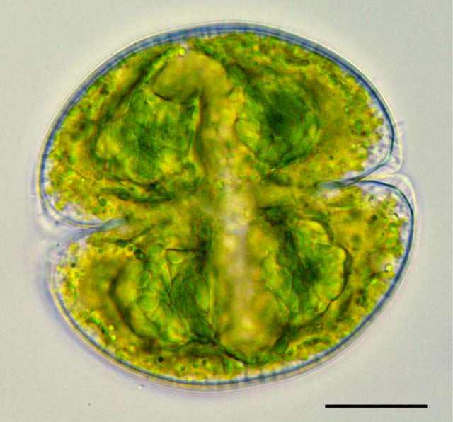ツヅミモ （Cosmarium texichondrum）の画像