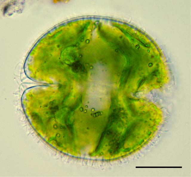 ツヅミモ （Cosmarium texichondrum）の画像