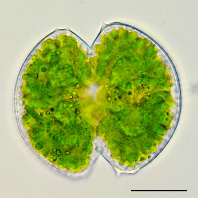 ツヅミモ （Cosmarium sp.）の画像