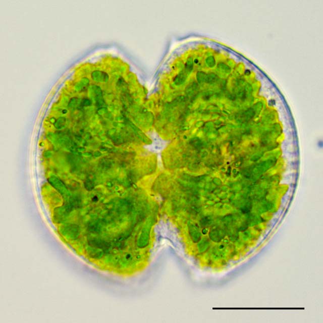 ツヅミモ （Cosmarium sp.）の画像