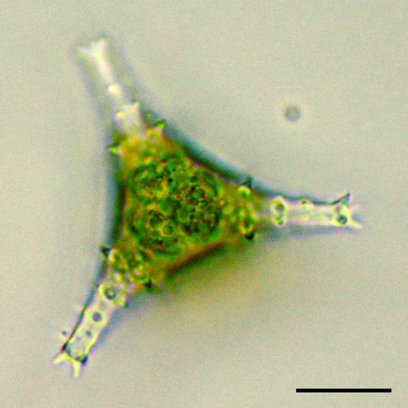 スタウラスツルム（Staurastrum sp.）の画像