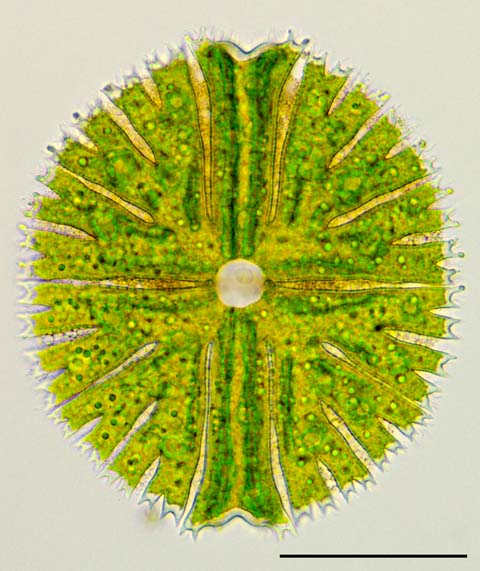 ミクラステリアス （Micrasterias sp.）の画像
