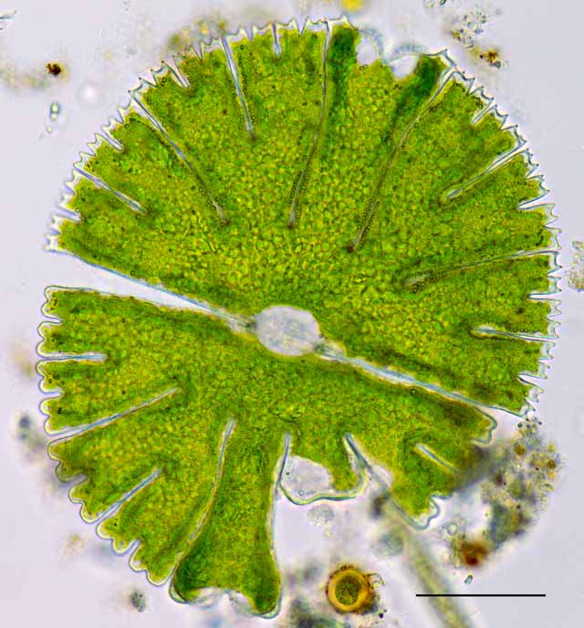 ミクラステリアス（Micrasterias thomasiana）の画像