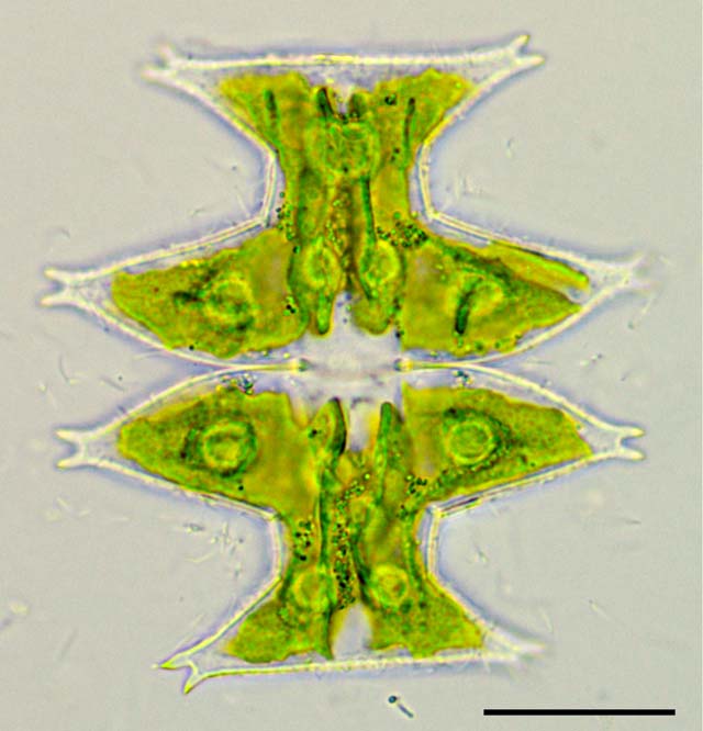 ミクラステリアス （Micrasterias pinnatifida）の画像