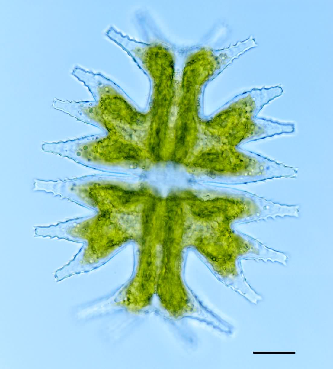 ミクラステリアス（Micrasterias mahabuleschwarensis var. wallichii ）の画像