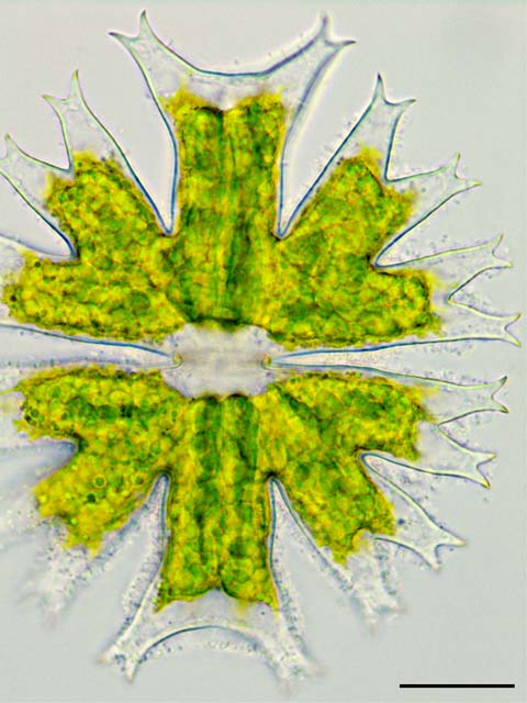 ミクラステリアス （Micrasterias crux-melitensis）の画像