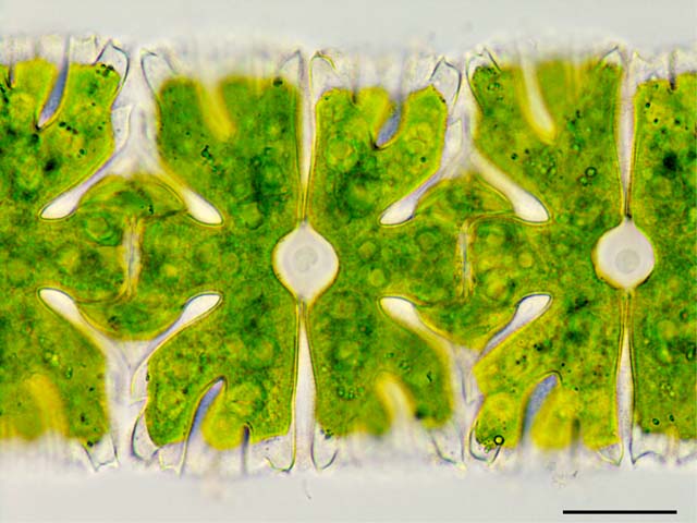 ミクラステリアス （Micrasterias foliacea）の画像