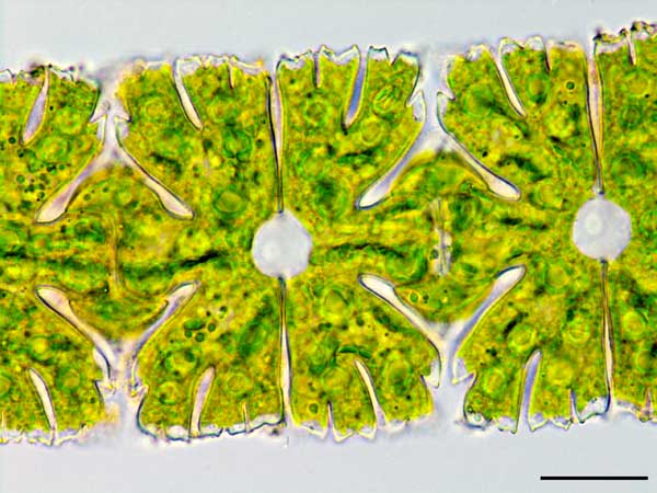 ミクラステリアス （Micrasterias foliacea）の画像