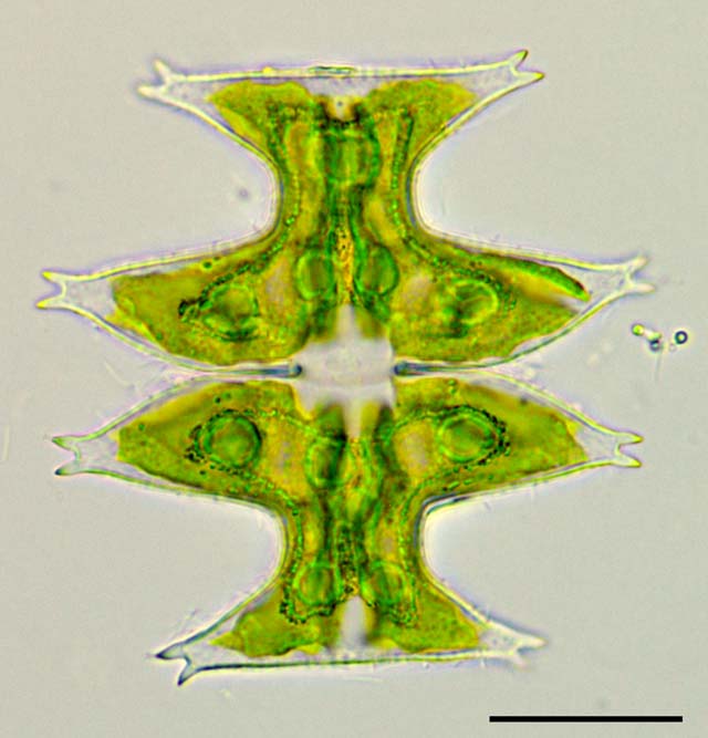 ミクラステリアス （Micrasterias pinnatifida）の画像