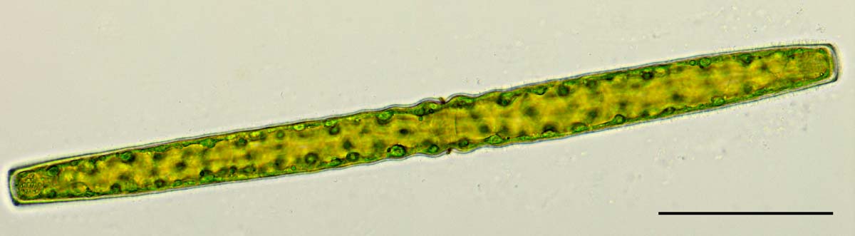 コウガイチリモ （Pleurotaenium sp.）の画像