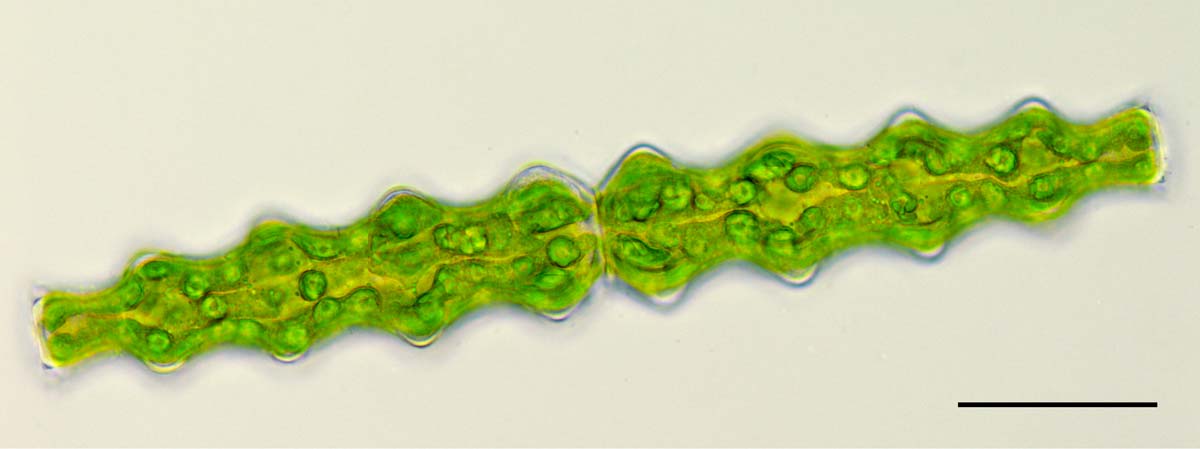 コウガイチリモ （Pleurotaenium nodosum）の画像