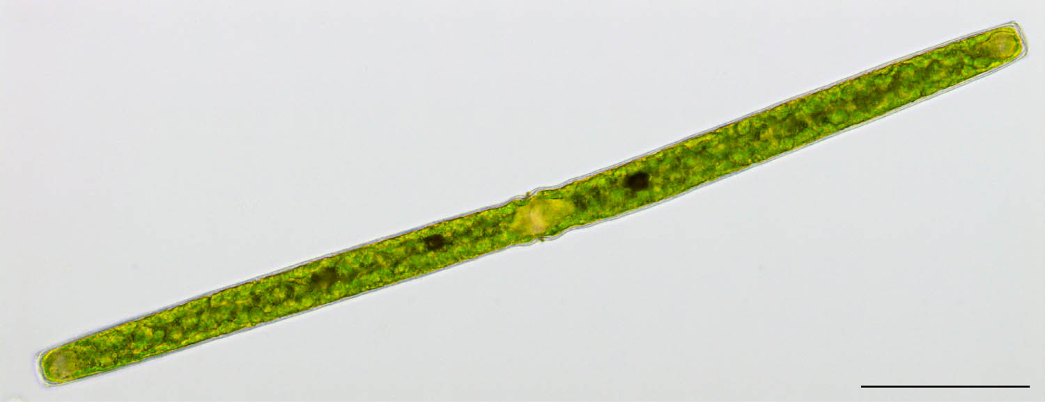 コウガイチリモ （Pleurotaenium sp.）の画像