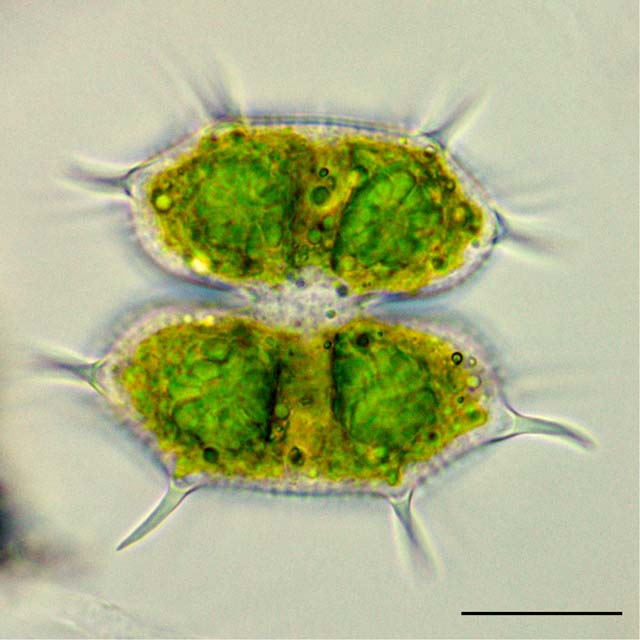クサンチディウム （Xanthidium sp.）の画像