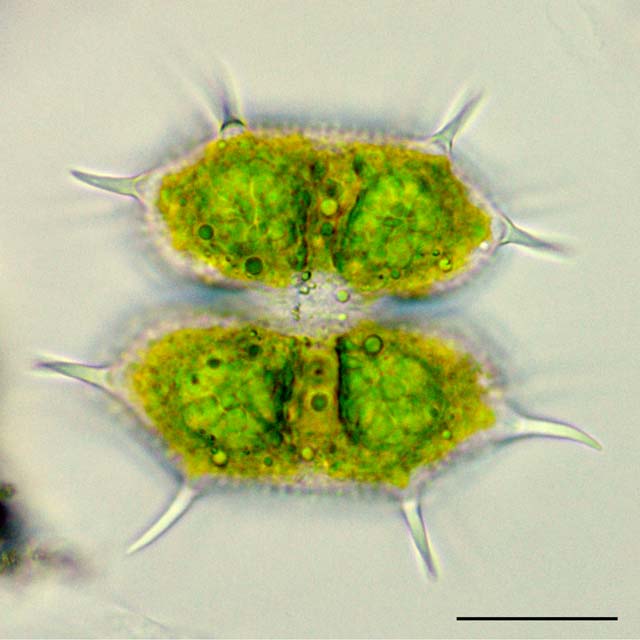 クサンチディウム （Xanthidium sp.）の画像