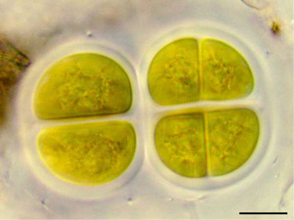 クロオコックス（Chroococcus sp.） の画像