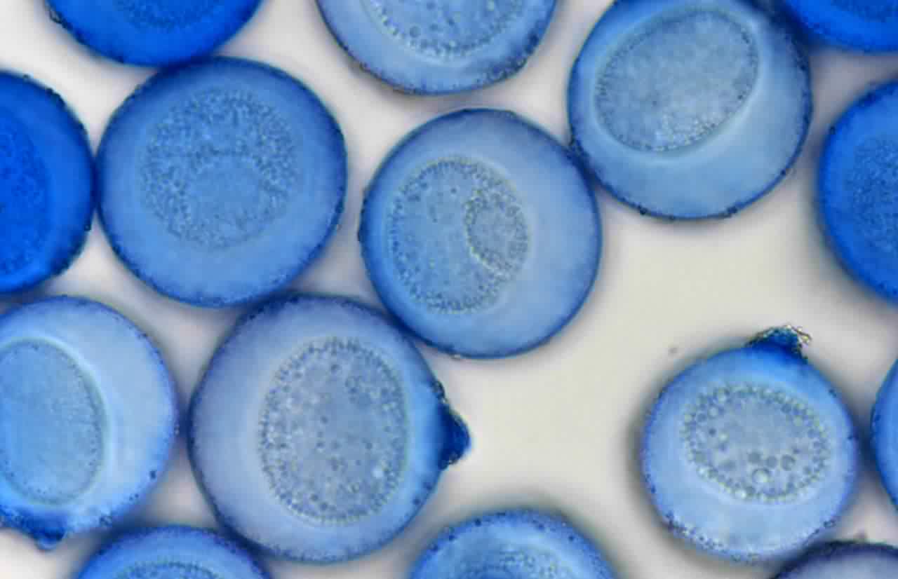 青色に染色したスギ花粉の顕微鏡写真です。