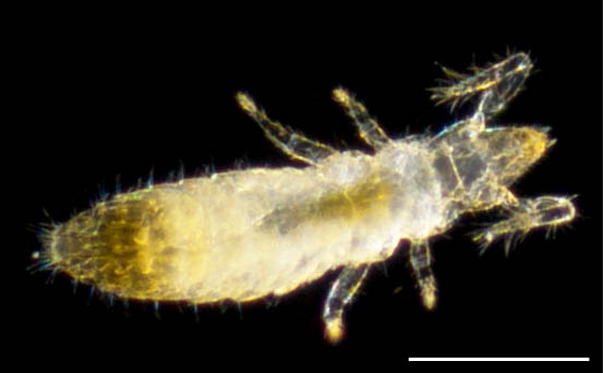 カマアシムシ目の１種 (Protura gen. sp.)