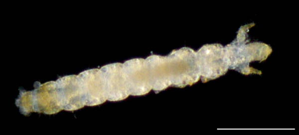 カマアシムシ目の１種 (Protura gen. sp.)