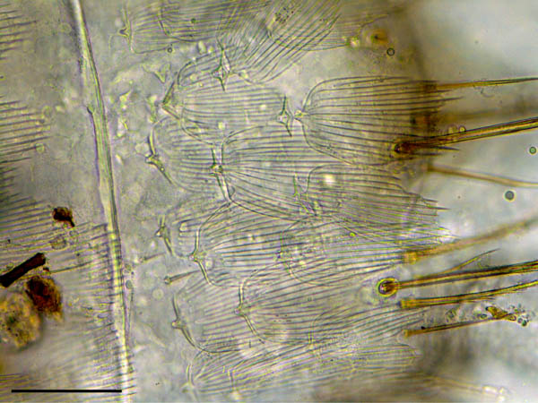 コムシ目（双尾目）の１種 (Diplura gen. sp.)