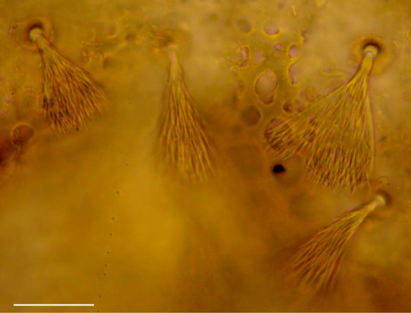 フサゲモンツキダニ属 の1種(Allonothrus sp.)