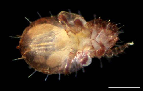 モンツキダニ科(Trhypochthoniellidae)の1種