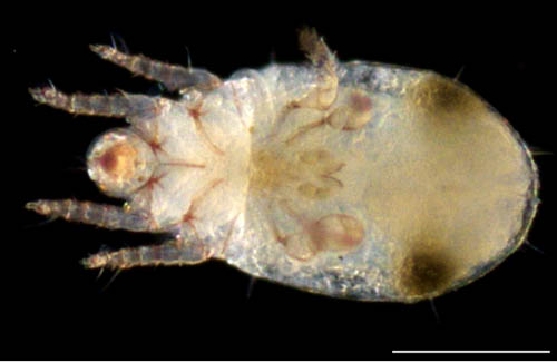 モンツキダニ科(Trhypochthoniellidae)の1種