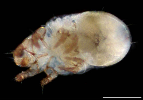 モンツキダニ科(Trhypochthoniellidae)の1種