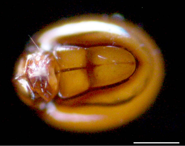 イレコダニ科(Phthiracaridae)の1種