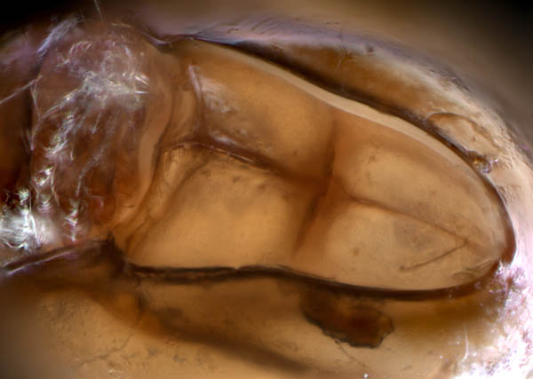 イレコダニ科(Phthiracaridae)の1種