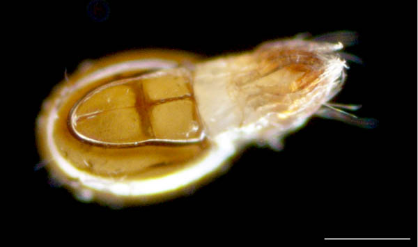 イレコダニ科(Phthiracaridae)の1種