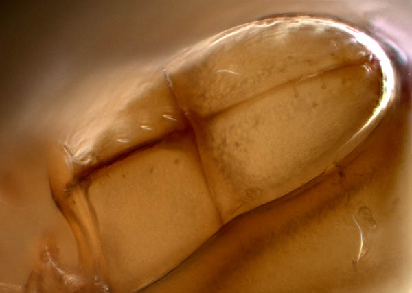 イレコダニ科(Phthiracaridae)の1種