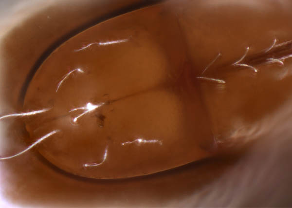 イレコダニ科(Phthiracaridae)の1種