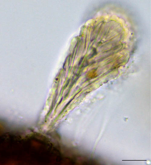 アミメオニダニ属の1種 （Nothrus sp.01）