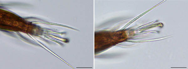 アミメオニダニ属の1種 （Nothrus sp.01）