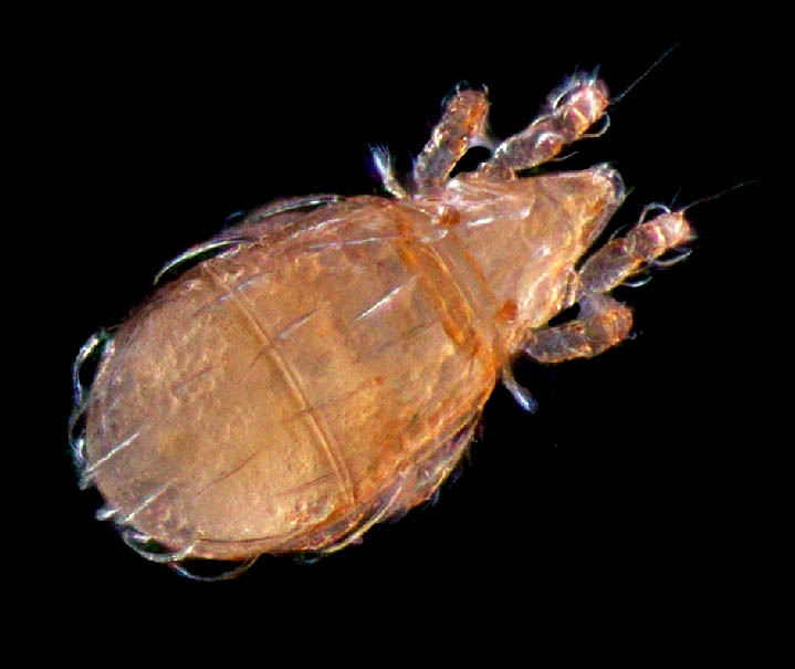 ナガヒワダニ属の1種 （Eohypochthonius sp.）